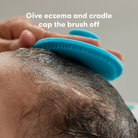 Person using a blue brush on头皮 with text about eczema and cradle cap.