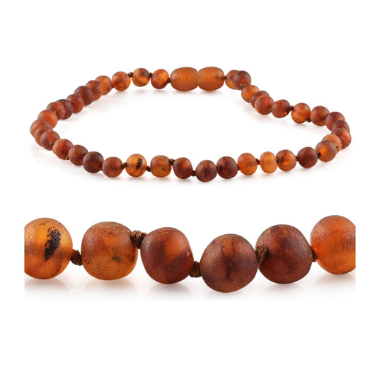 Raw Cognac Baltic Amber Necklace